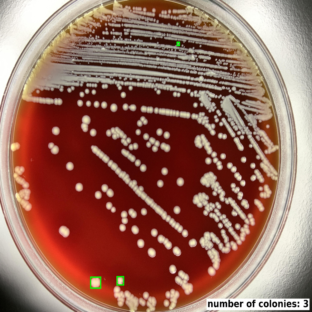 Pick Colony 1.0 - CarbConnect AI-powered medical imaging analysis tool for healthcare professionals and research institutions